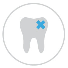 odontoiatria_conservativa