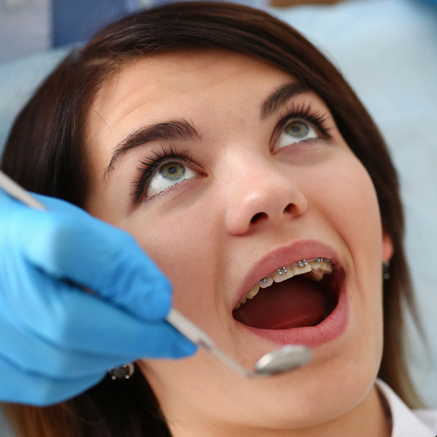 Ortodonzia e Allineatori, Centro Dental Smile Oristano