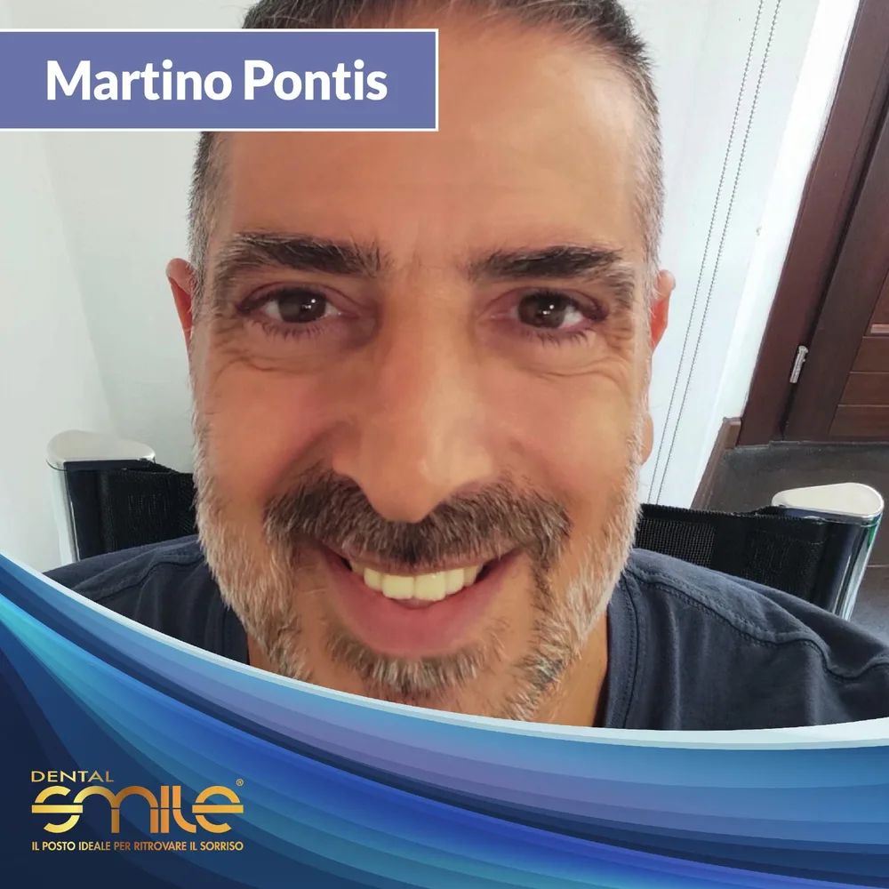 Martino Pontis, paziente Centro Dental Smile Oristano