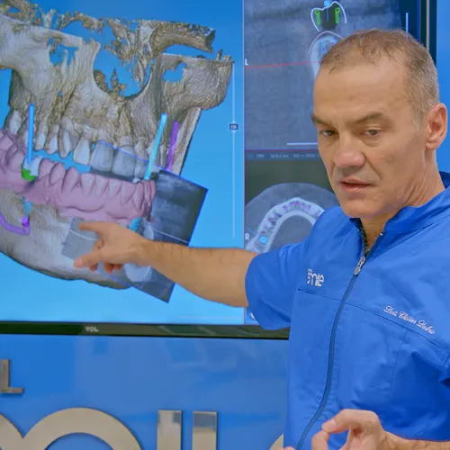 Pianificazione digitale 3D basata su TAC, Centro Dental Smile Oristano