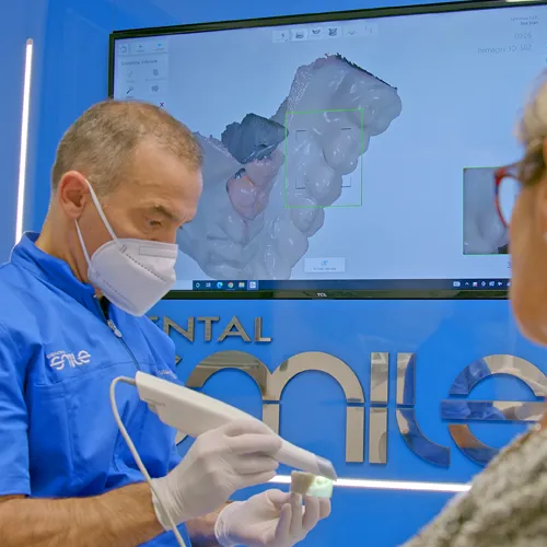 Scanner intraorale per impronta digitale, Centro Dental Smile Oristano